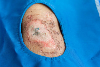 Close-up of man with blue eye