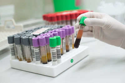 Cropped hand of scientist testing chemical in laboratory