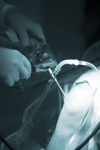 Cropped hands of surgeon operating patient at hospital