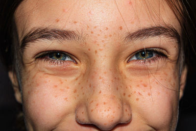 Close-up portrait of smiling girl