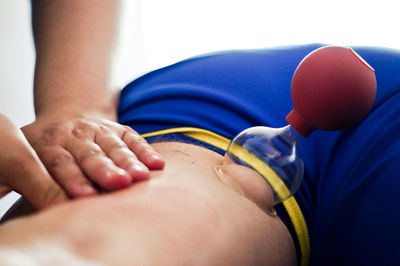 Close-up of vacuum cupping therapy 