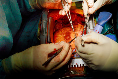 Close-up of surgeon operating on heart of patient