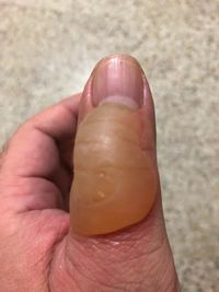 finger
