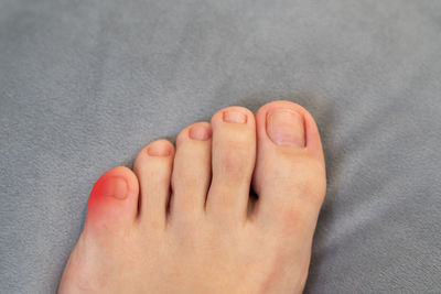 toe