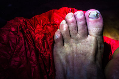 Low section of person with injured toenail