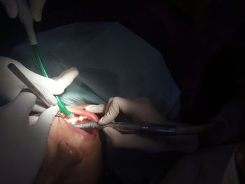 Cropped hands of dentist examining patient