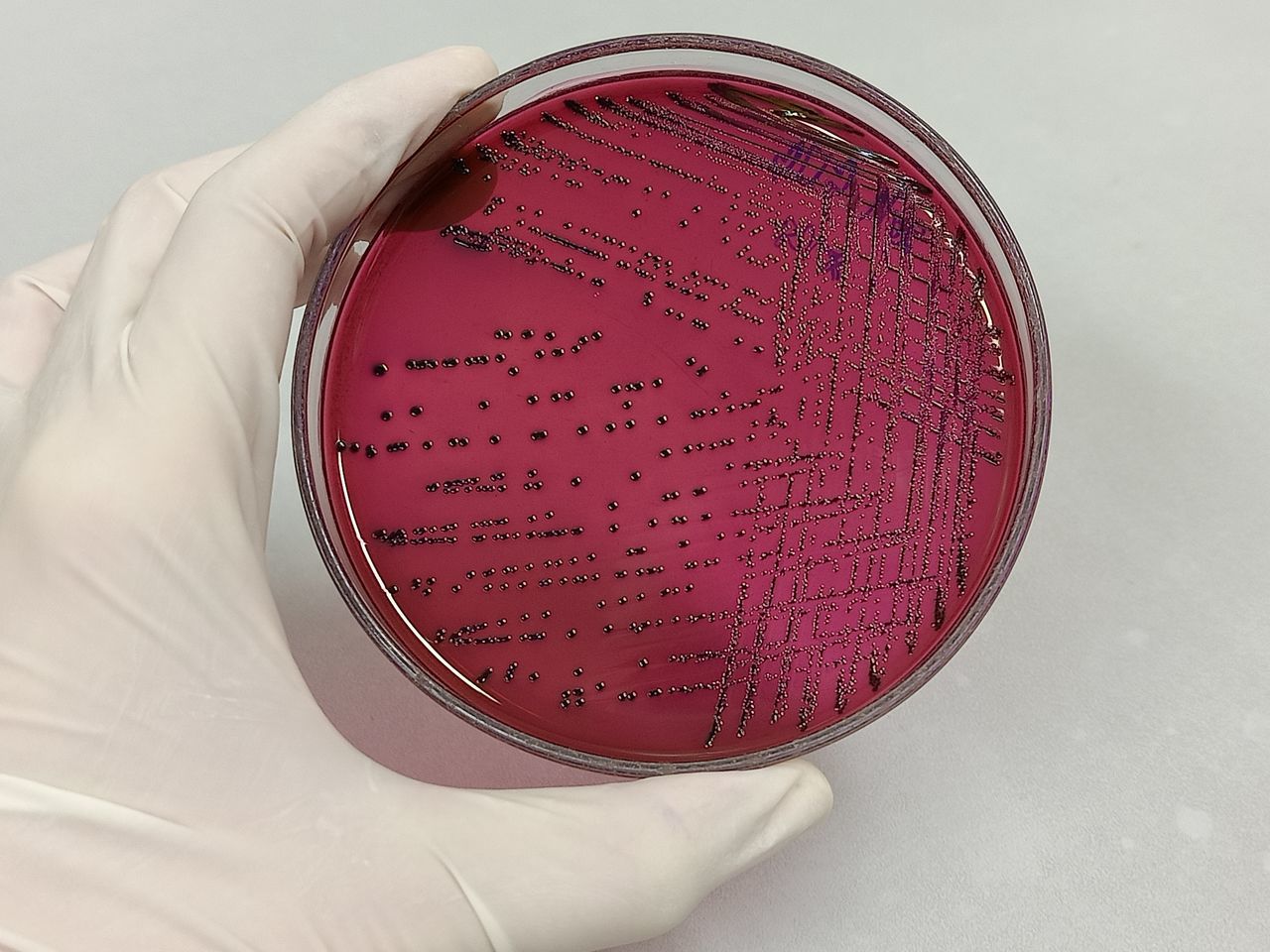 pink, red, science, research, scientific experiment, biology, laboratory, lip, indoors, education, medical research, biochemistry, healthcare and medicine, petri dish, microbiology, hand, one person, holding, human eye, close-up, biotechnology, protection, studio shot, circle