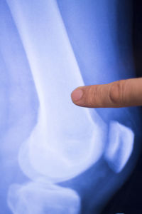 Cropped hand of doctor examining medical x-ray