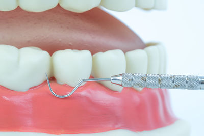 Close up dental model object with dental tool,hook