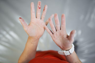 Crop unrecognizable female in sportswear demonstrating hands in chalk and blood after training in bouldering center