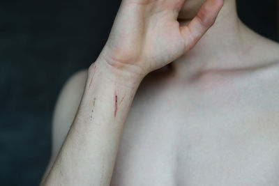 Midsection of shirtless mid adult man with wounded hand against black background