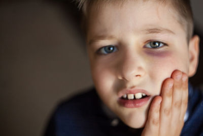 A boy with a bruised eye after a fight or violence