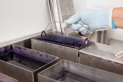 Scientist staining microscope slides for cytology studies in the laboratory.