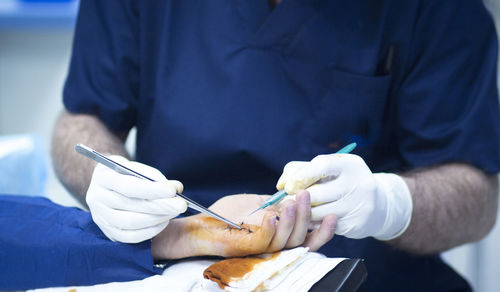 Midsection of doctor stitching injured hand in hospital