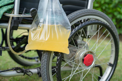 Asian lady woman patient sitting on wheelchair with urine bag in the hospital  