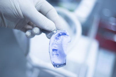 Cropped hand of person holding dental mold