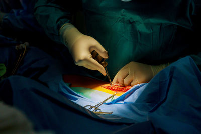 Midsection of doctor operating patient at operation theater