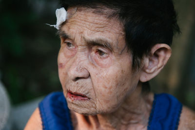 Woman with injured forehead outdoors