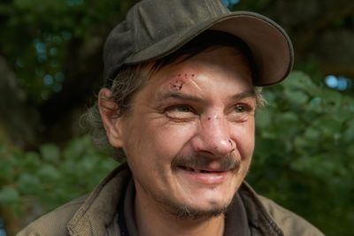 Portrait of smiling man, scratched face, wearing hat