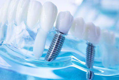 Close-up of artificial teeth