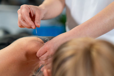 Unrecognizable physiotherapist inserting needle into shoulder of relaxed female patient during acupuncture session in clinic