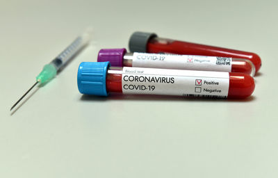 Coronavirus covid 19 infected positive result blood test sample