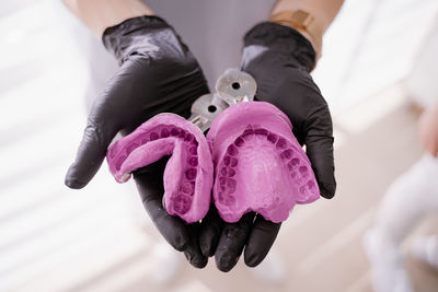 The orthodontist holds purple casts of the jaw in his hands, the process of orthodontic treatment