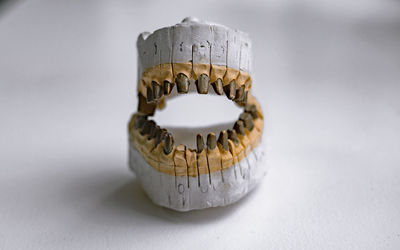 Tooth casts for prosthetics