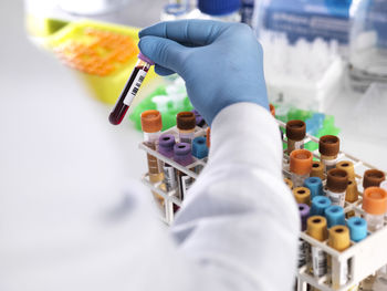 Close-up of laboratory technician holding blood sample for medical testing