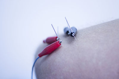 Close-up of person skin with electro acupuncture against white background