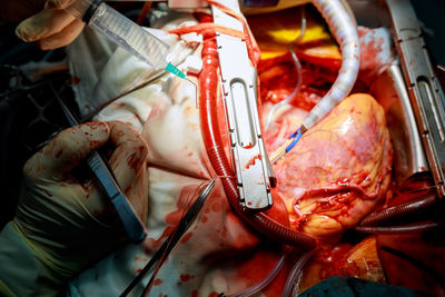 Cropped hands of doctors operating patient in hospital