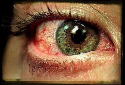 human eye