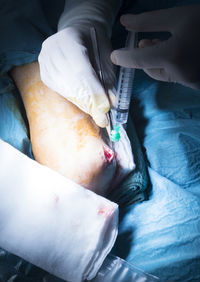 Cropped hands of doctors doing knee surgery in operating room