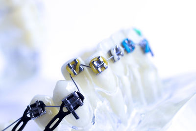 Close-up of dental equipment