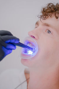 Orthodontist shine an ultraviolet lamp on the braces for material hardening