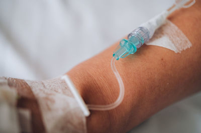 Close-up of human hand with iv drip