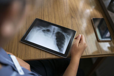 Digital tablet showing x-ray