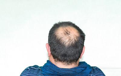 Rear view of man with receding hairline against white background