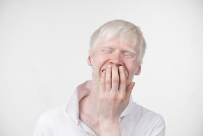 Young man with albino laughing against white background