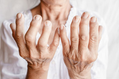 Close-up of senior woman with wrinkled fractured hands