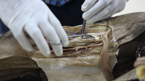 Cropped hands of doctor doing surgery in hospital