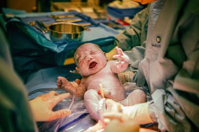 High angle view of doctors holding baby at hospital