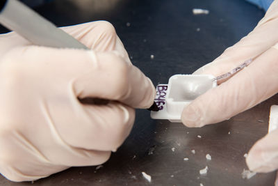 Scientist preparing paraffin blocks containing biopsy tissue for sectioning. pathology laboratory.