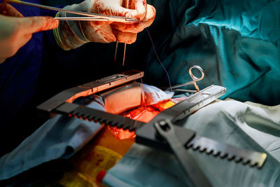 Doctor performing surgery in operating room