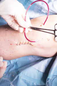 Cropped hand of doctor holding scissors and pipe while performing surgery