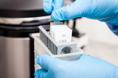 Scientist preparing slides with biopsy tissue samples for immunohistochemistry assay .