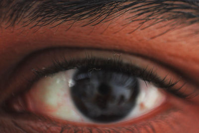 Close-up of human eye