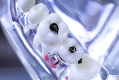 Close-up of artificial decay teeth