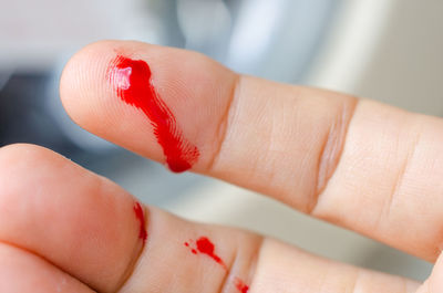 Cropped finger of person bleeding