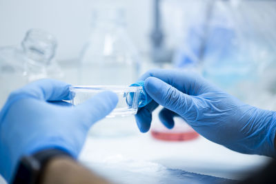 Cropped hand of scientist examining patient